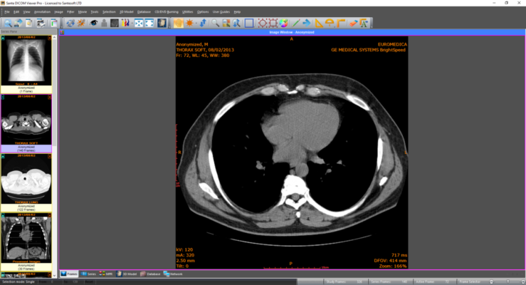 Sante DICOM Viewer Pro 14.2.6 – A snapshot of the explanation